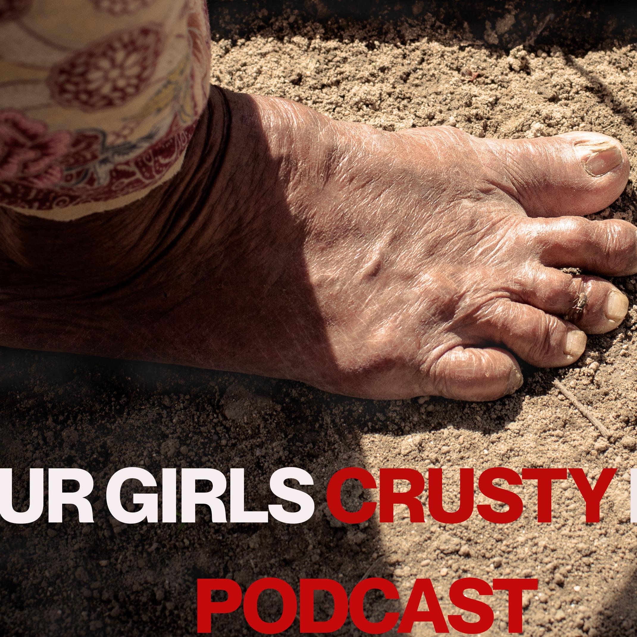 Your Girls Crusty Foot